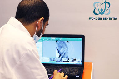 دكتور أسنان - معرض صور المركز - افضل مركز اسنان في مصر - مركز وندرز لعلاج الاسنان