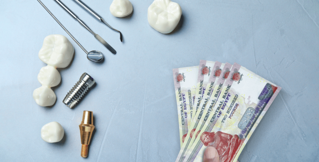 أنواع زراعة الأسنان - مركز وندرز لعلاج الاسنان انواع زراعة الاسنان