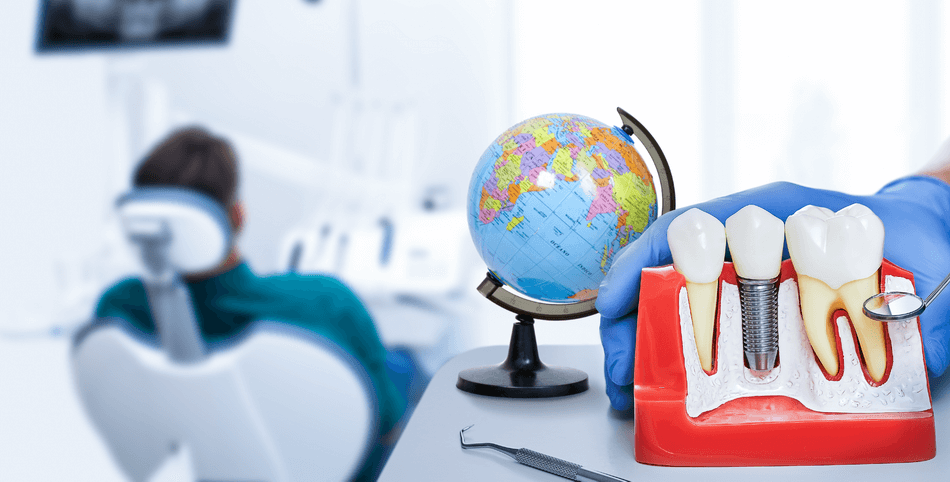 أفضل-البلاد-لزراعة-الأسنان (1) أفضل بلاد زراعة الأسنان - مركز وندرز لعلاج الاسنان