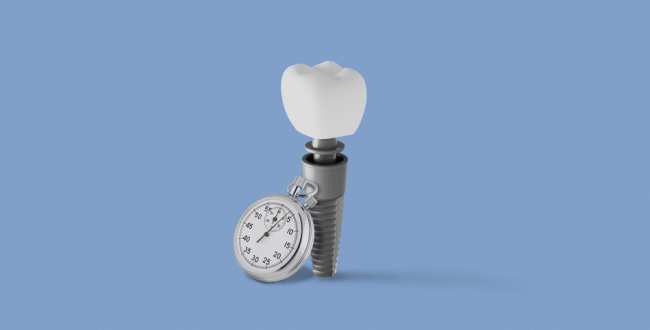 أفضل-موعد-للزراعة (1) زراعة الاسنان بعد الخلع - مركز وندرز لعلاج الاسنان