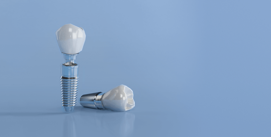 أنواع-تركيبات (1) انواع تركيبات الأسنان - مركز وندرز لعلاج الاسنان - انواع تركيبات الاسنان - Types of dental prosthetics