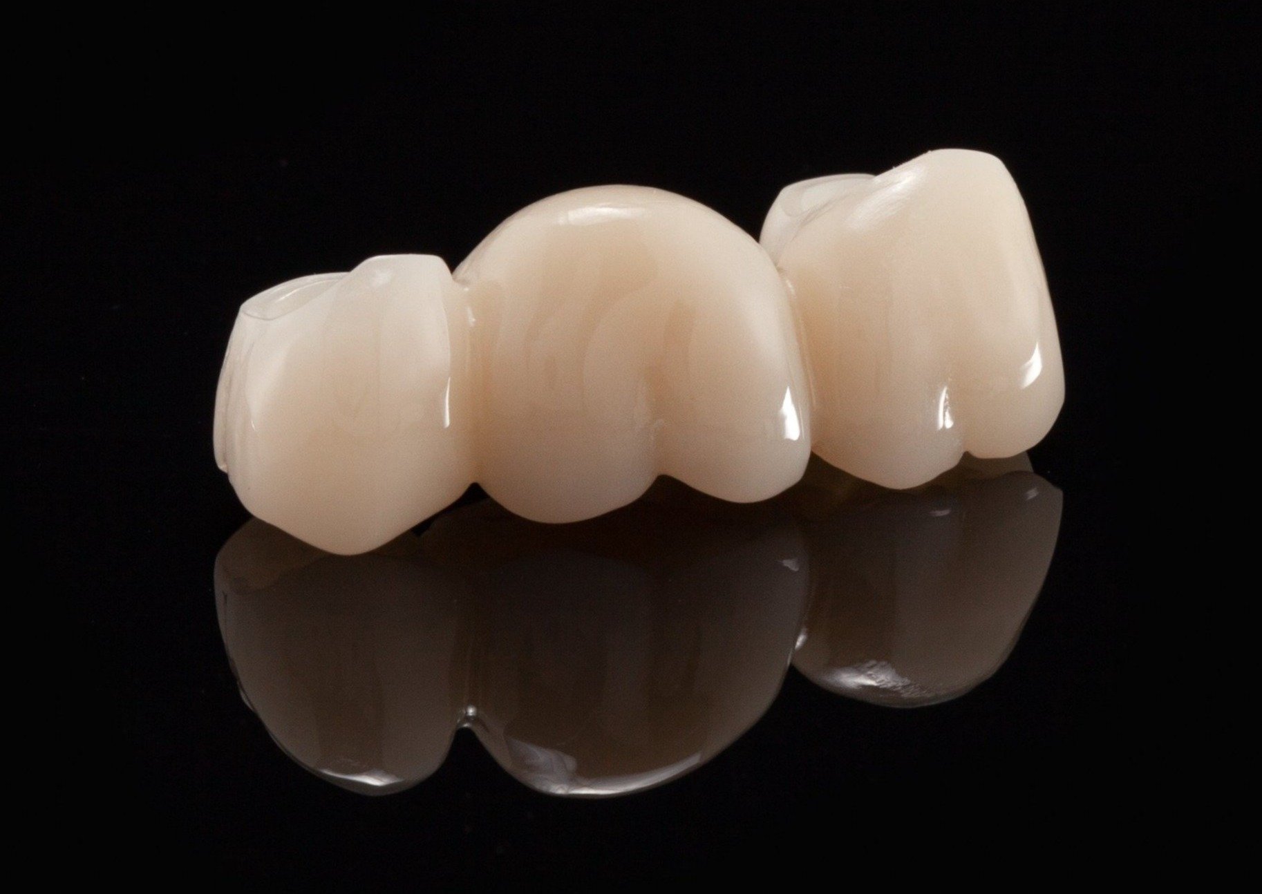 انواع تركيبات الأسنان - مركز وندرز لعلاج الاسنان - انواع تركيبات الاسنان - تركيبات الأسنان PMMA