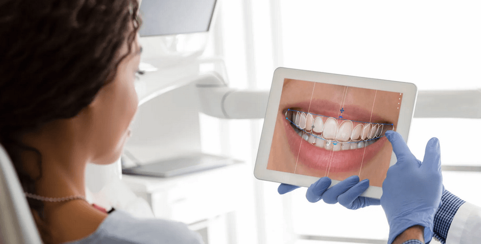 هوليود سمايل - مركز وندرز لعلاج الاسنان - ابتسامة هوليود