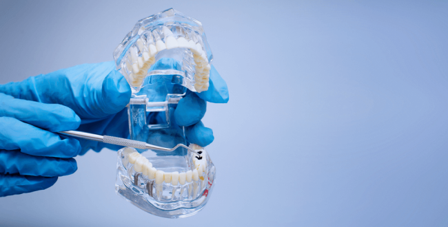 حشو-العصب (1) جاتا بيركا - مركز وندرز لعلاج الاسنان