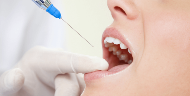 بنج-الأسنان (1) بنج الأسنان - مركز وندرز لعلاج الاسنان - بنج الاسنان - Dental Anesthesia