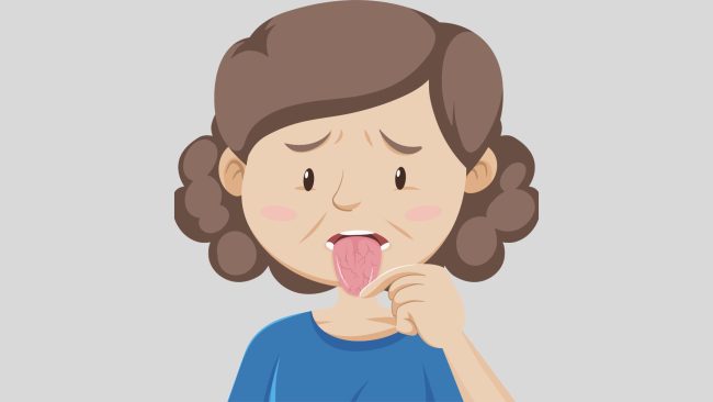 DRY Mouth جفاف الفم - مركز وندرز لعلاج الاسنان