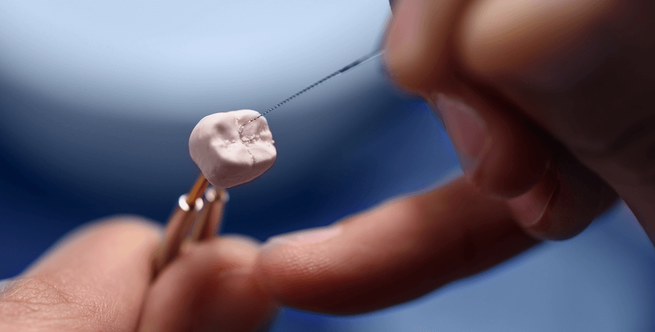 برد-الأسنان-وعملية-نحت-الأسنان (1) برد الاسنان - مركز وندرز لعلاج الاسنان