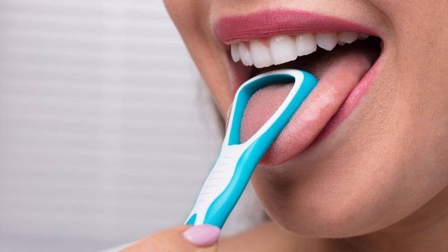 Clean tongue (1) تنظيف اللسان - مركز وندرز لعلاج الاسنان
