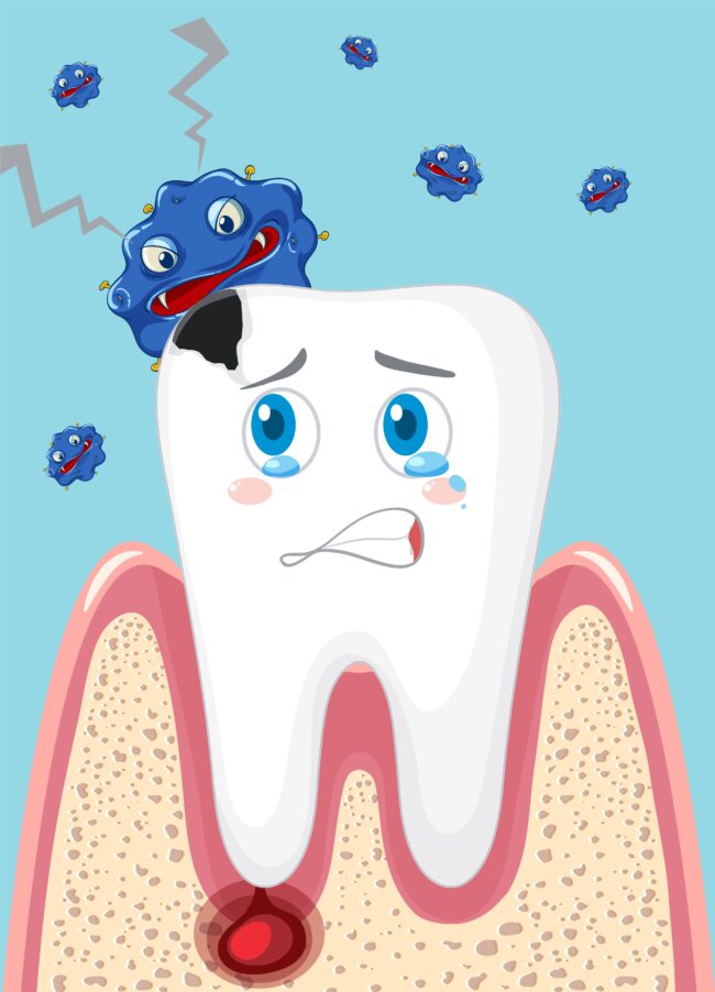 Cartoon tooth decay with bacteria on blue background التهاب الأسنان - Tooth inflammation