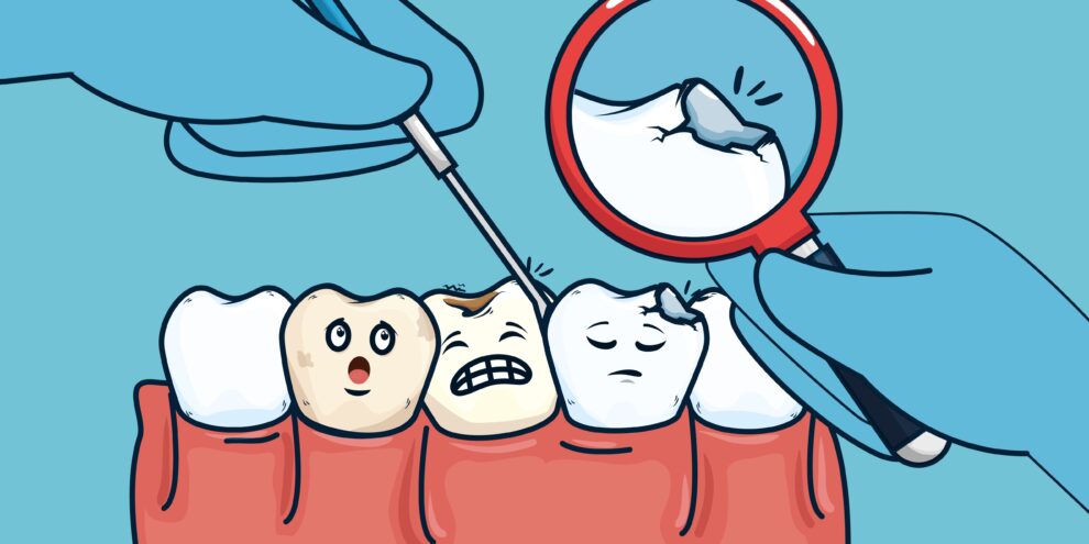 تزاحم الأسنان - tooth crowding