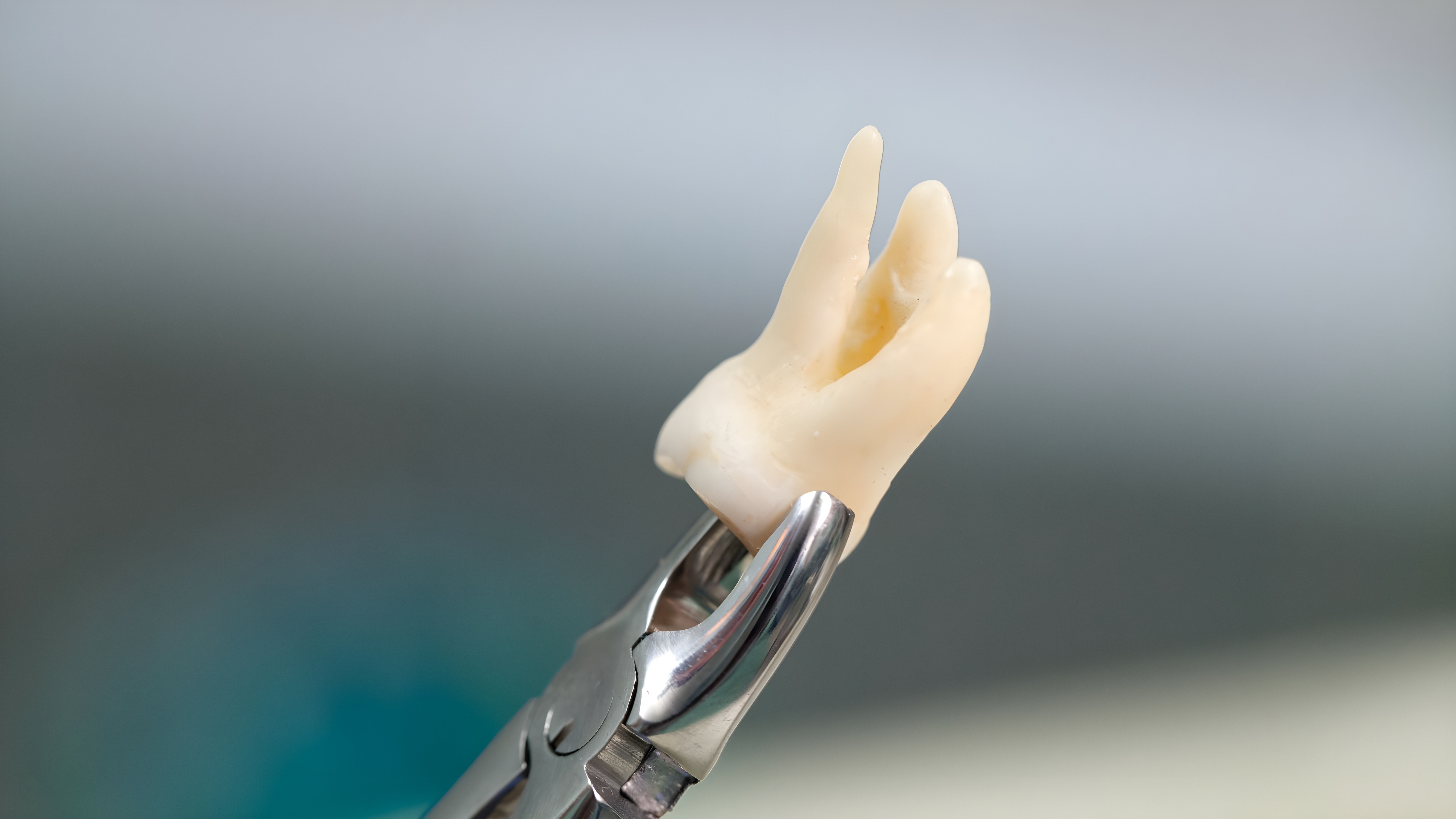 إجراء خلع الأسنان - Tooth Extraction Procedure