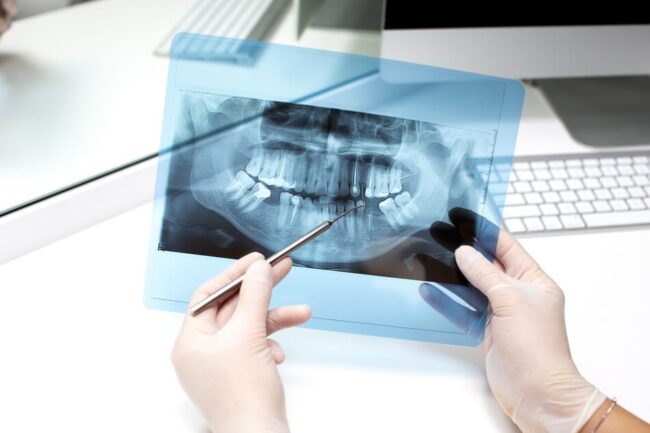 dentist-analyzes-x-ray-photo اشعة الاسنان