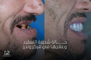 مركز وندرز لعلاج الأسنان - عيادات ووندرز لعلاج الأسنان