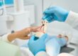 سعر حشو العصب - Root Canal Treatment Cost
