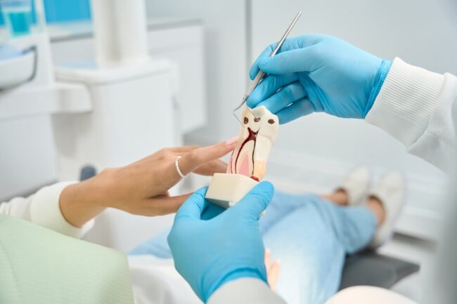 سعر حشو العصب - Root Canal Treatment Cost