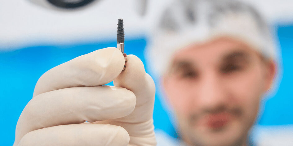 إزالة زراعة الأسنان - Dental Implant Removal